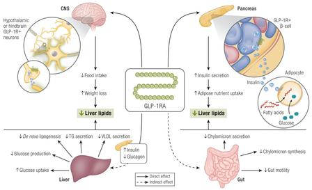 Four core pathways of GLP-1 peptides in improving fatty liver