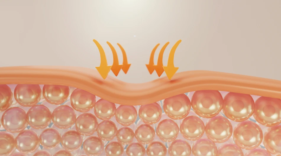 Repair-Regeneration-and-Fibrosis